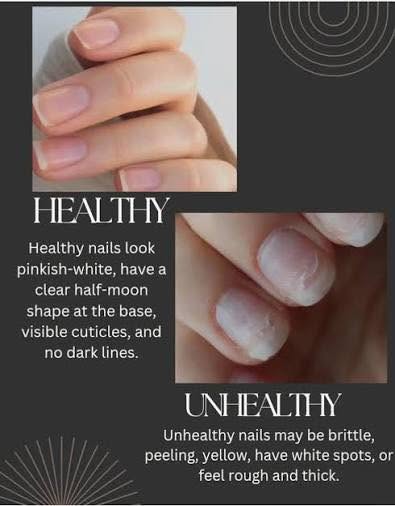Summer Nail Care & Self-Care,